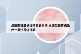 点滴型银屑病住院多长时间 点滴型银屑病治疗一周还是进行期