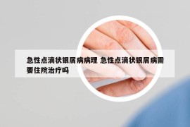 急性点滴状银屑病病理 急性点滴状银屑病需要住院治疗吗