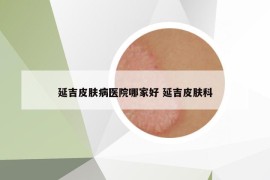 延吉皮肤病医院哪家好 延吉皮肤科