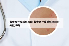 长春八一皮肤科医院 长春八一皮肤科医院对外就诊吗
