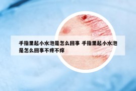 手指里起小水泡是怎么回事 手指里起小水泡是怎么回事不疼不痒