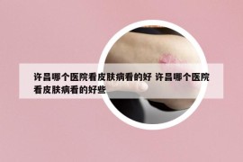 许昌哪个医院看皮肤病看的好 许昌哪个医院看皮肤病看的好些