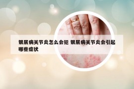 银屑病关节炎怎么会犯 银屑病关节炎会引起哪些症状