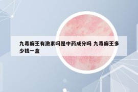 九毒癣王有激素吗是中药成分吗 九毒癣王多少钱一盒