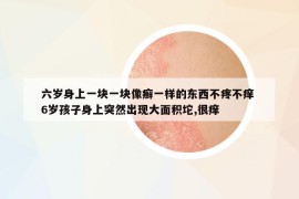 六岁身上一块一块像癣一样的东西不疼不痒 6岁孩子身上突然出现大面积坨,很痒