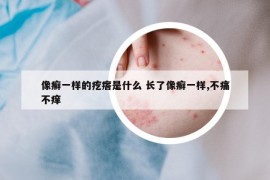 像癣一样的疙瘩是什么 长了像癣一样,不痛不痒