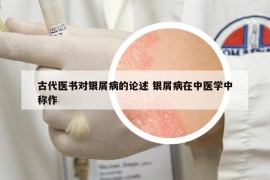 古代医书对银屑病的论述 银屑病在中医学中称作