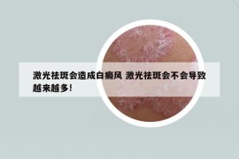 激光祛斑会造成白癜风 激光祛斑会不会导致越来越多!