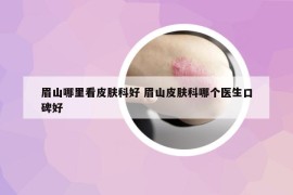 眉山哪里看皮肤科好 眉山皮肤科哪个医生口碑好