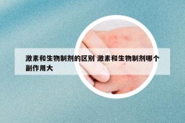 激素和生物制剂的区别 激素和生物制剂哪个副作用大