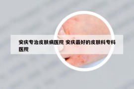 安庆专治皮肤病医院 安庆最好的皮肤科专科医院