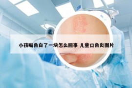 小孩嘴角白了一块怎么回事 儿童口角炎图片