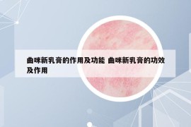 曲咪新乳膏的作用及功能 曲咪新乳膏的功效及作用