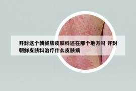 开封这个朝鲜族皮肤科还在那个地方吗 开封朝鲜皮肤科治疗什么皮肤病