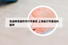 南通哪家医院可打可善挺 上海能打可善挺的医院