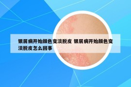银屑病开始颜色变淡脱皮 银屑病开始颜色变淡脱皮怎么回事