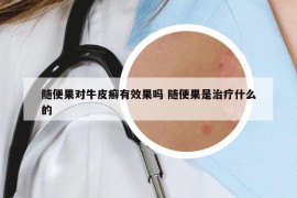 随便果对牛皮癣有效果吗 随便果是治疗什么的