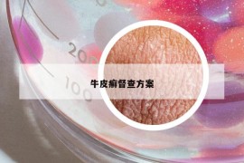 牛皮癣督查方案