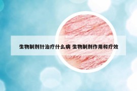 生物制剂针治疗什么病 生物制剂作用和疗效