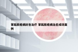 掌跖脓疱病封包治疗 掌跖脓疱病治愈成功案例