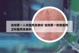 信阳第一人民医院皮肤科 信阳第一附属医院卫校医院皮肤科