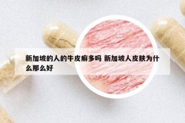 新加坡的人的牛皮癣多吗 新加坡人皮肤为什么那么好
