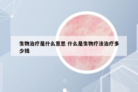生物治疗是什么意思 什么是生物疗法治疗多少钱
