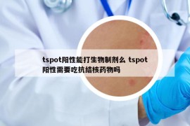 tspot阳性能打生物制剂么 tspot阳性需要吃抗结核药物吗