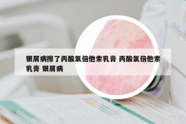 银屑病擦了丙酸氯倍他索乳膏 丙酸氯倍他索乳膏 银屑病