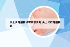 头上长疙瘩用红霉素软膏吗 头上长红疙瘩用药