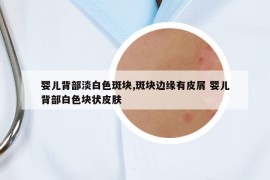 婴儿背部淡白色斑块,斑块边缘有皮屑 婴儿背部白色块状皮肤