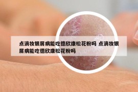 点滴妆银屑病能吃德欣康松花粉吗 点滴妆银屑病能吃德欣康松花粉吗