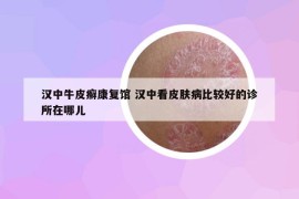 汉中牛皮癣康复馆 汉中看皮肤病比较好的诊所在哪儿