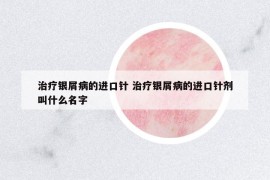 治疗银屑病的进口针 治疗银屑病的进口针剂叫什么名字