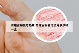奇康百癣夏塔热片 奇康百癣夏塔热片多少钱一盒