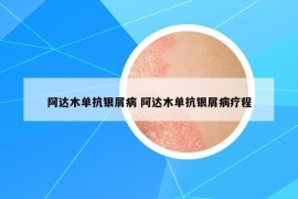 阿达木单抗银屑病 阿达木单抗银屑病疗程