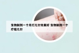 生物制剂一个月打几针效果好 生物制剂一个疗程几针