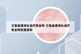 三氧血液净化治疗安全吗 三氧血液净化治疗安全吗百度百科