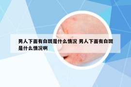 男人下面有白斑是什么情况 男人下面有白斑是什么情况啊