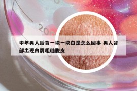 中年男人后背一块一块白是怎么回事 男人背部出现白屑粗糙脱皮