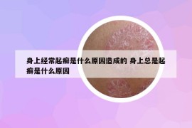 身上经常起癣是什么原因造成的 身上总是起癣是什么原因