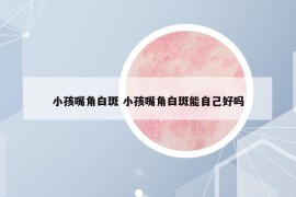 小孩嘴角白斑 小孩嘴角白斑能自己好吗