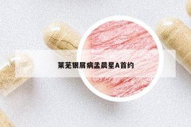 莱芜银屑病孟晨星A首约
