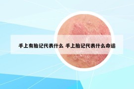 手上有胎记代表什么 手上胎记代表什么命运