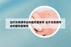 治疗白斑病专业的医院是哪家 治疗白斑病专业的医院是哪家