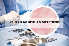 皮好癣有什么忌口的吗 皮癣患者吃什么调理?