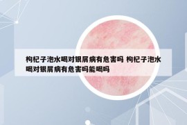枸杞子泡水喝对银屑病有危害吗 枸杞子泡水喝对银屑病有危害吗能喝吗