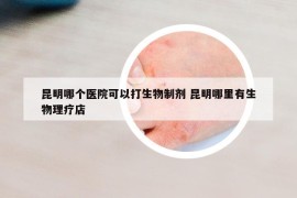 昆明哪个医院可以打生物制剂 昆明哪里有生物理疗店