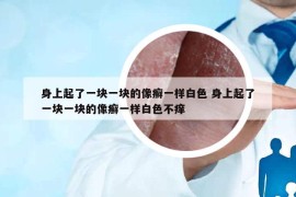 身上起了一块一块的像癣一样白色 身上起了一块一块的像癣一样白色不痒