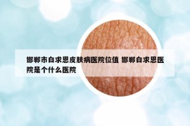 邯郸市白求恩皮肤病医院位值 邯郸白求恩医院是个什么医院